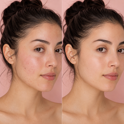 TOSOWOONG Arbutine 7% + Tranexaminezuur 4% Crème 50ml.